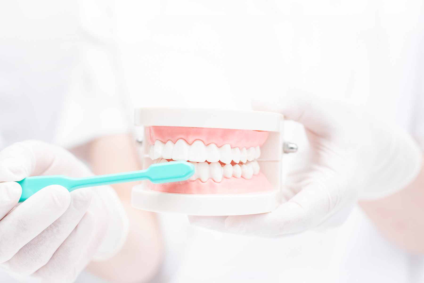 予防歯科のメリット・重要性